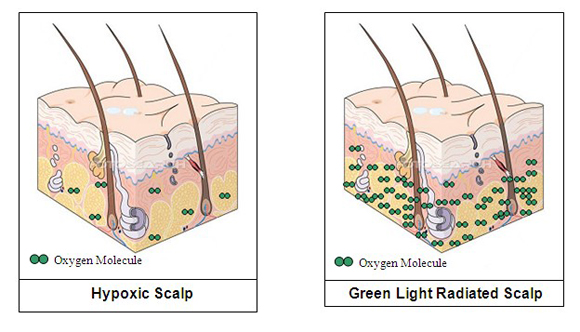 Hypoxic Scalp and Green Light Radiated Scalp